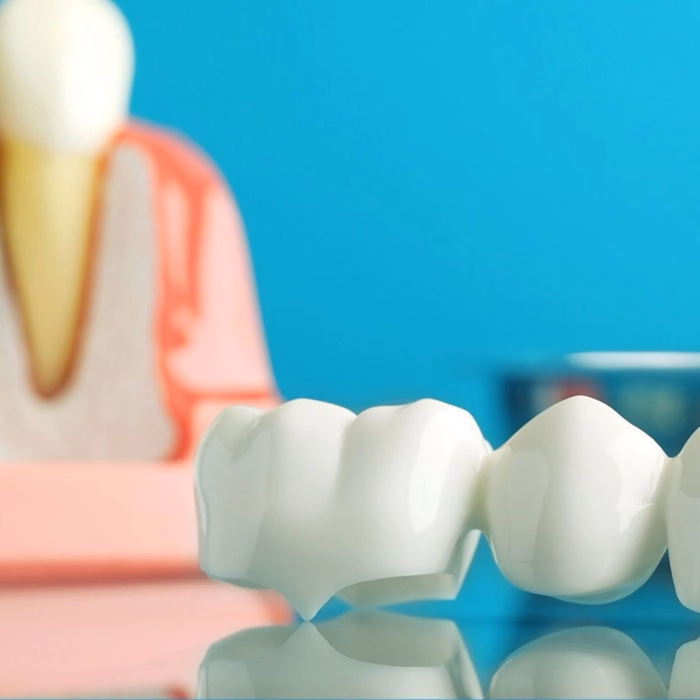 Ceramic dental prosthetic on a reflective surface