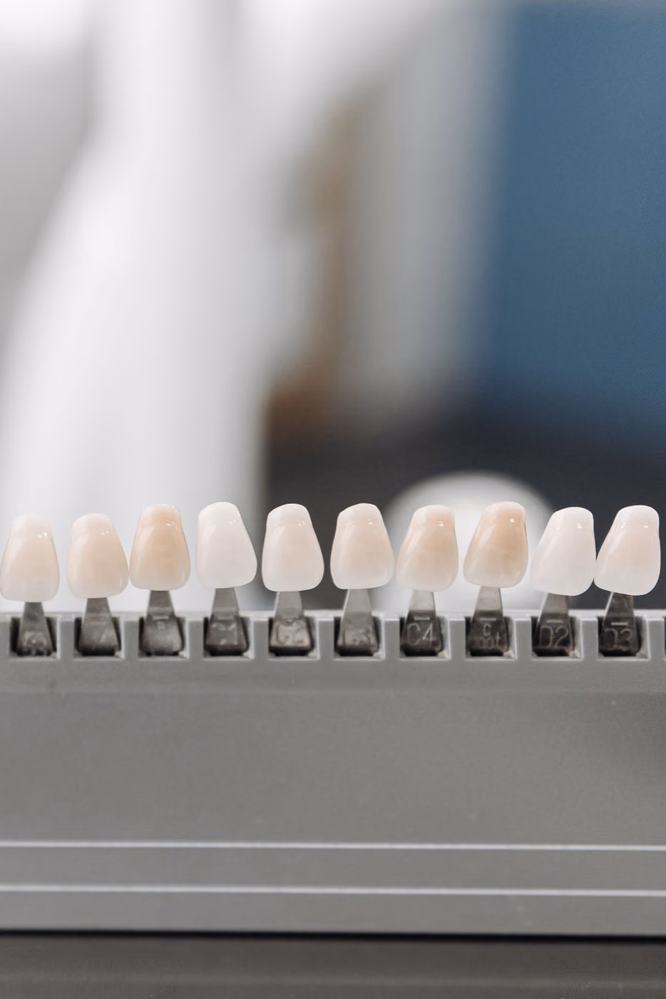 Porcelain veneer samples in a holder